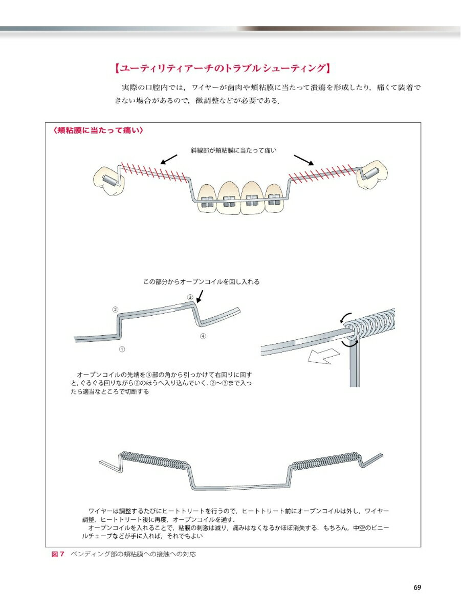 イラストと症例で学ぶ 開業医のための臨床部分矯正 咬合育成から補綴前矯正まで [ 徳永 哲彦 ] 3