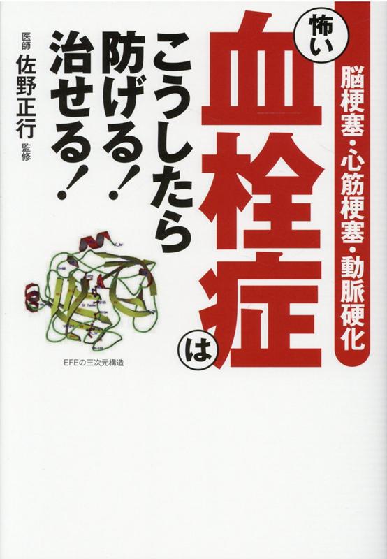 怖い血栓症はこうしたら防げる！治せる！