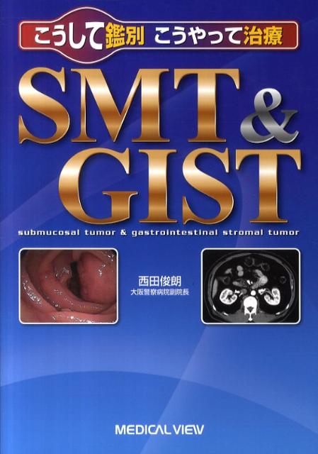 こうして鑑別こうやって治療SMT＆GIST
