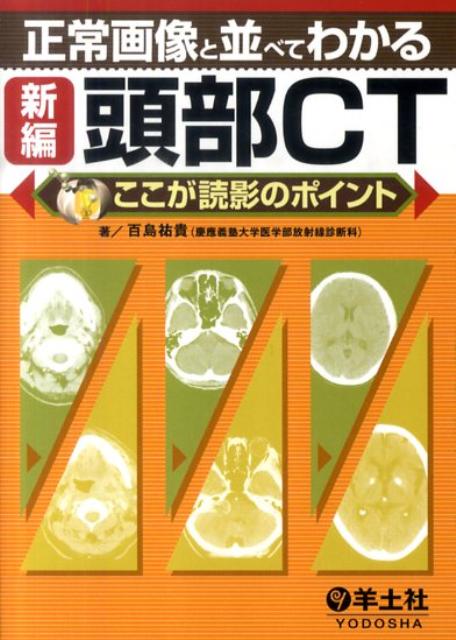 正常画像と並べてわかる新編頭部CT