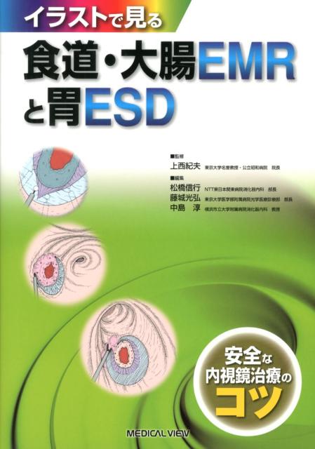 偶発症を防ぐポイントを徹底解説。初学者が知らなければならないエッセンスが満載。４００点以上のイラストで解説。ＥＭＲ・ＥＳＤがわかる入門書。