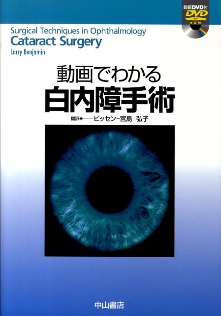 動画でわかる白内障手術