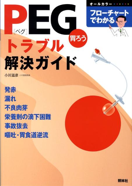 PEG胃ろうトラブル解決ガイド