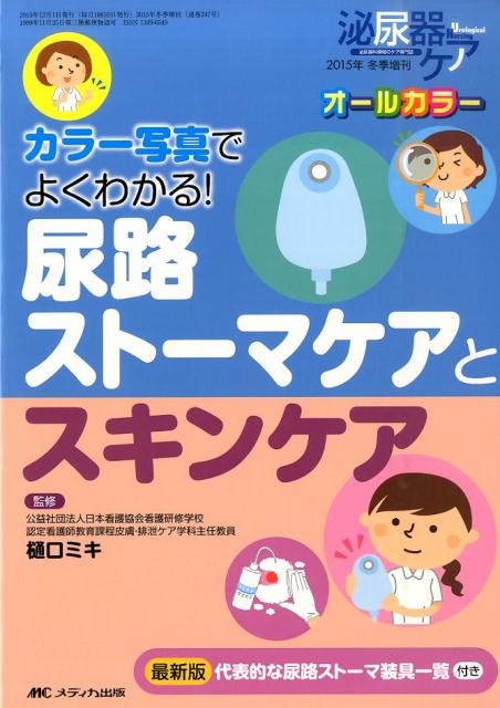 尿路ストーマケアとスキンケア