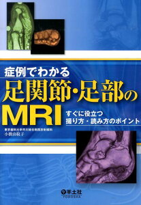 症例でわかる足関節・足部のMRI すぐに役立つ撮り方・読み方のポイント [ 小橋由紋子 ]