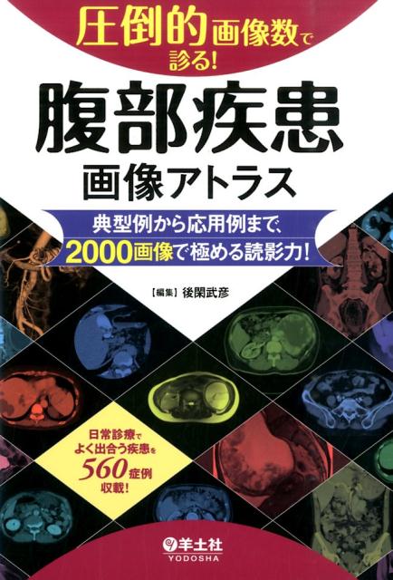 圧倒的画像数で診る！腹部疾患画像アトラス