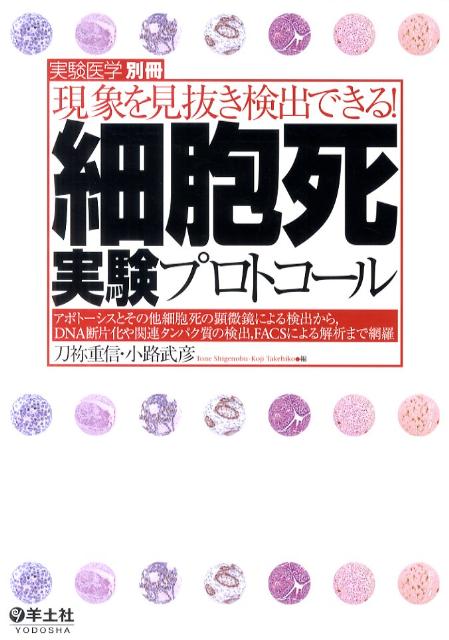 細胞死実験プロトコール 現象を見抜き検出できる！ 