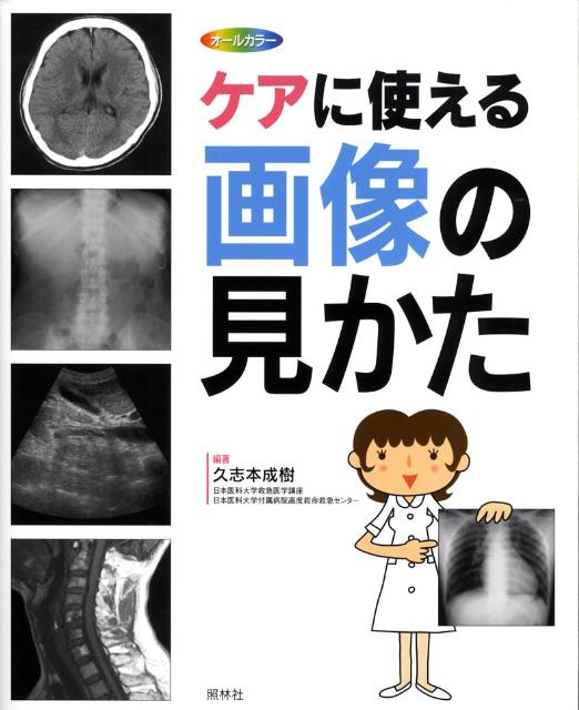 ケアに使える画像の見かた