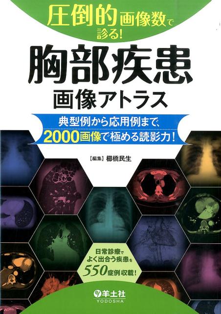 圧倒的画像数で診る!胸部疾患画像アトラス