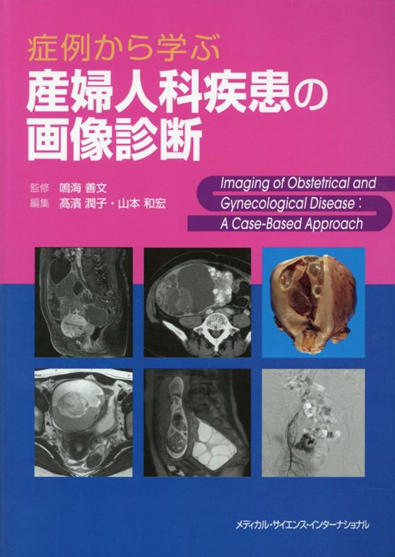 症例から学ぶ産婦人科疾患の画像診断 鳴海 善文