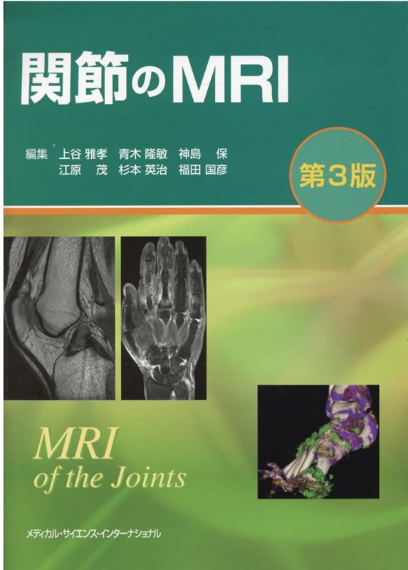 関節のMRI 上谷 雅孝