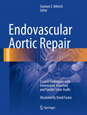 Endovascular Aortic Repair: Current Techniques with Fenestrated, Branched and Parallel Stent-Grafts ENDOVASCULAR AORTIC REPAIR 201 
