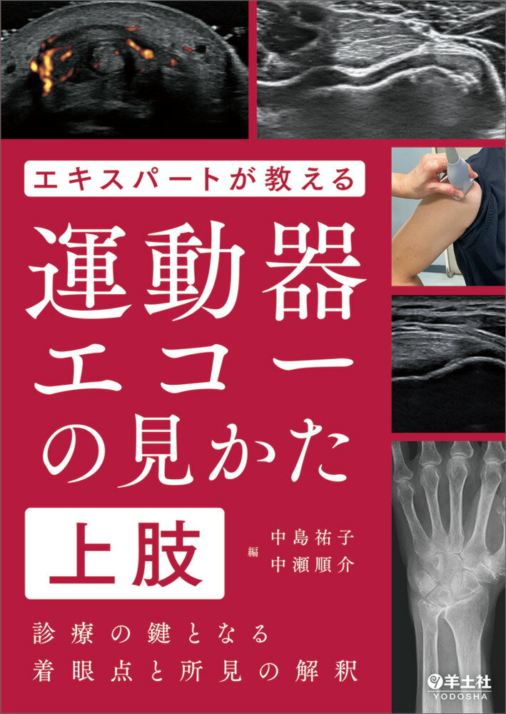 エキスパートが教える運動器エコーの見かた　上肢 