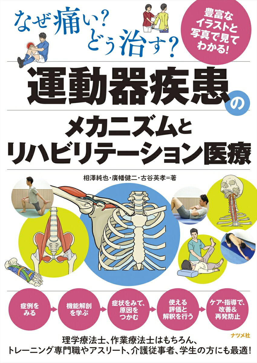 なぜ痛い？どう治す？運動器疾患のメカニズムとリハビリテーション医療 