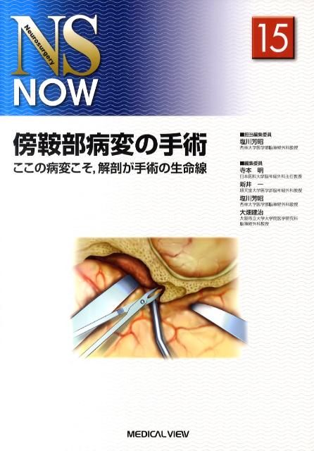 傍鞍部病変の手術