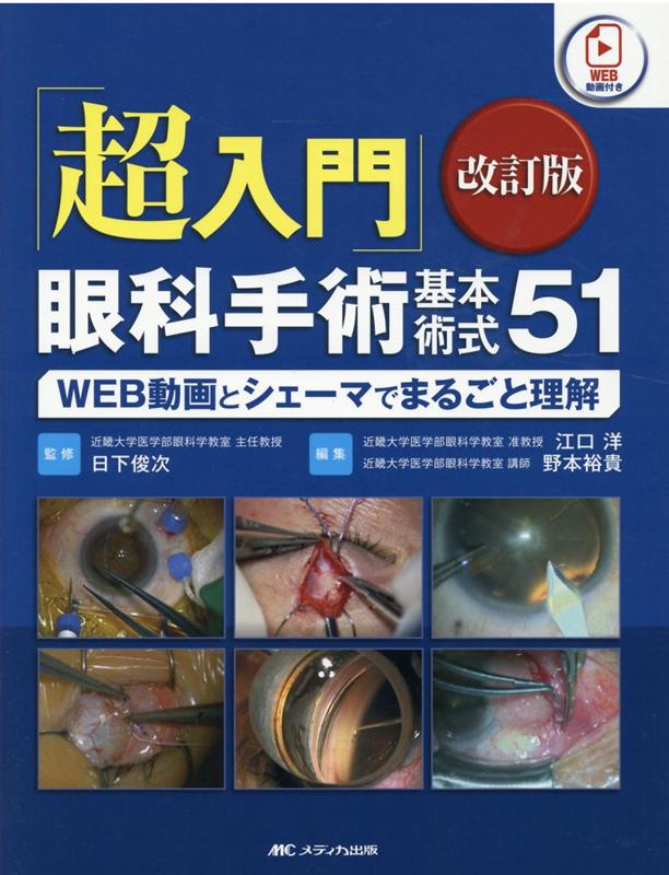 「超入門」眼科手術基本術式51　改訂版