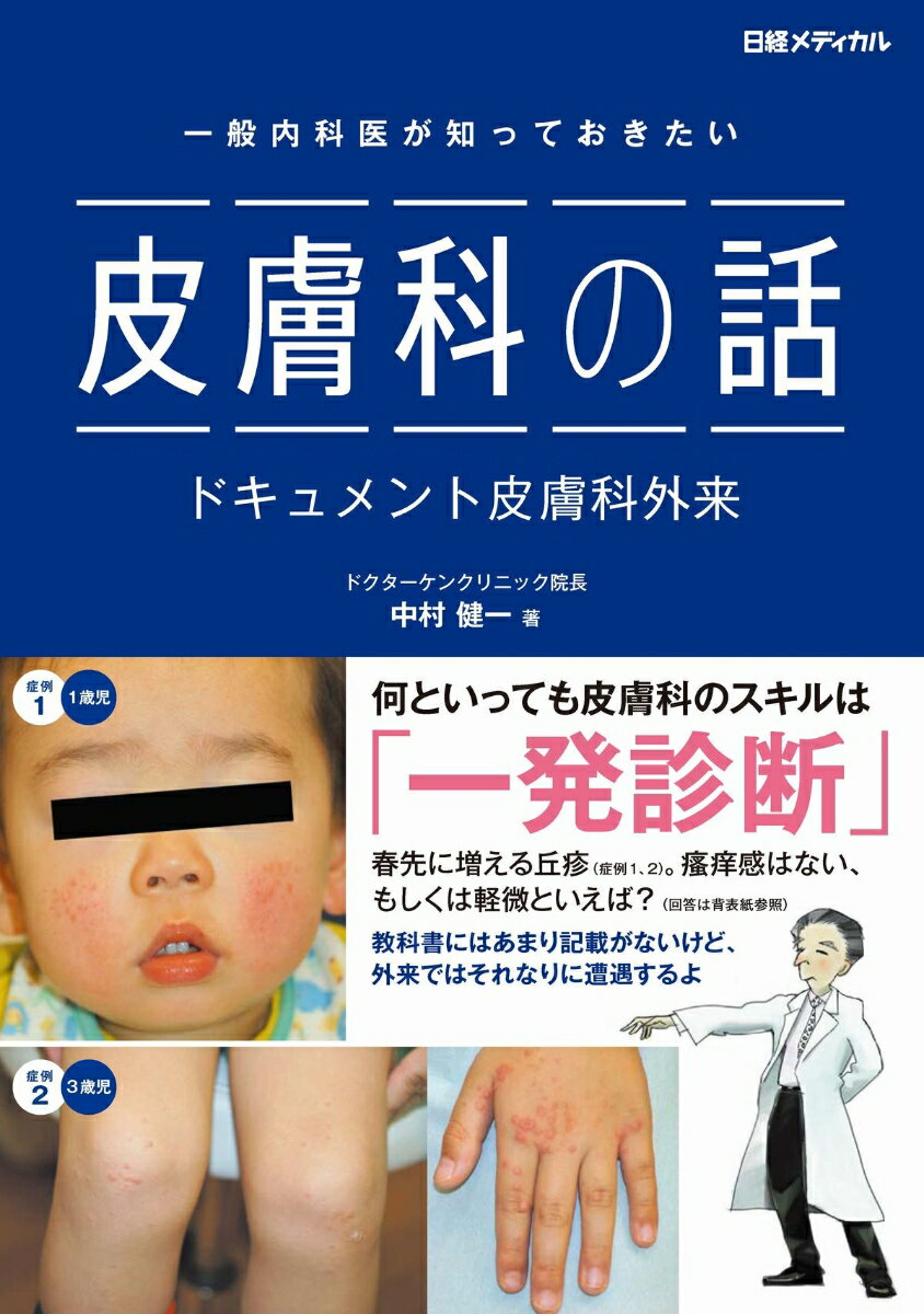 一般の内科外来で遭遇しやすい皮膚疾患を多数解説中！日経メディカルＯｎｌｉｎｅの人気連載を書籍化。