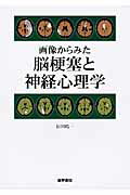 画像からみた脳梗塞と神経心理学