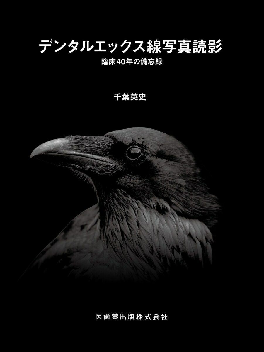 デンタルエックス線写真読影