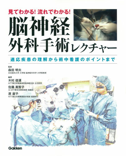 見てわかる！流れでわかる！脳神経外科手術レクチャー