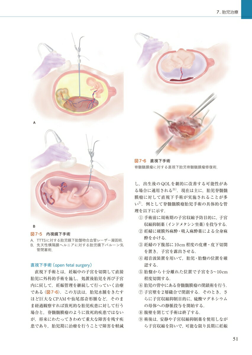 周産期マニュアル 胎児疾患の診断から管理まで [ 佐村 修 ] 3