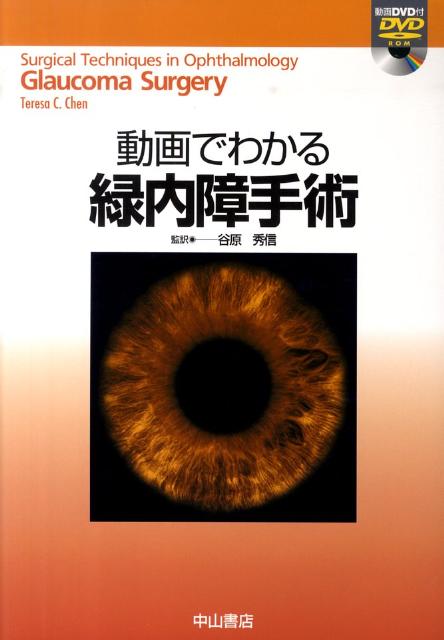 動画でわかる緑内障手術