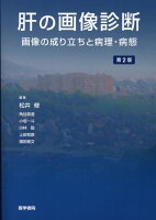 肝の画像診断 第2版