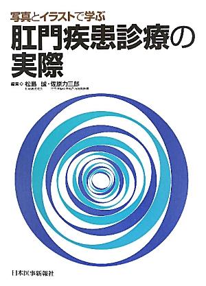 写真とイラストで学ぶ肛門疾患診療の実際