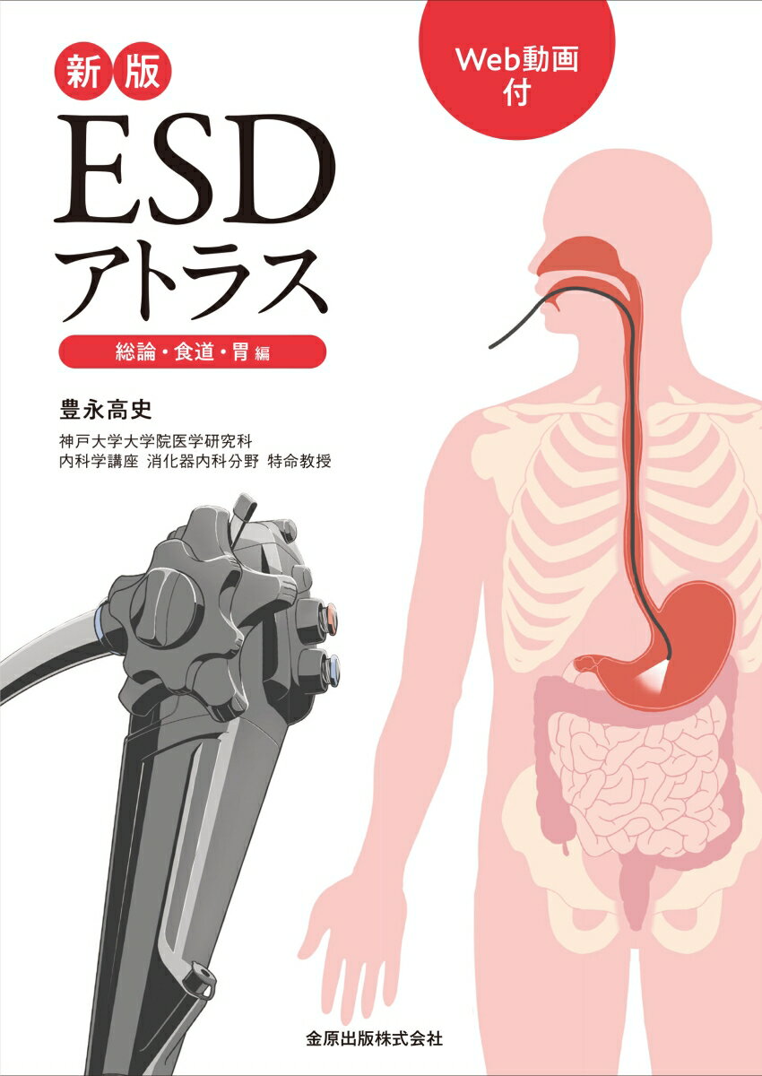 新版ESDアトラス 総論 食道 胃 編［Web動画付］ 豊永 高史
