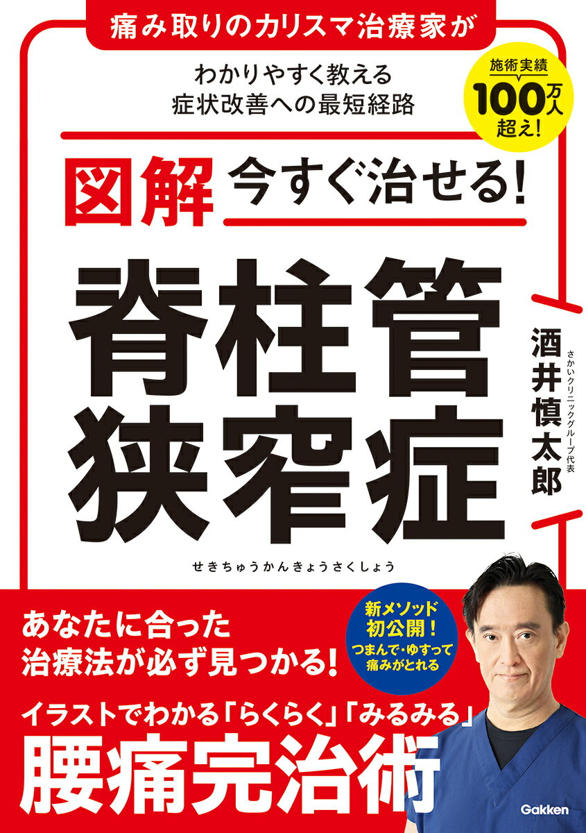 図解 今すぐ治せる！ 脊柱管狭窄症