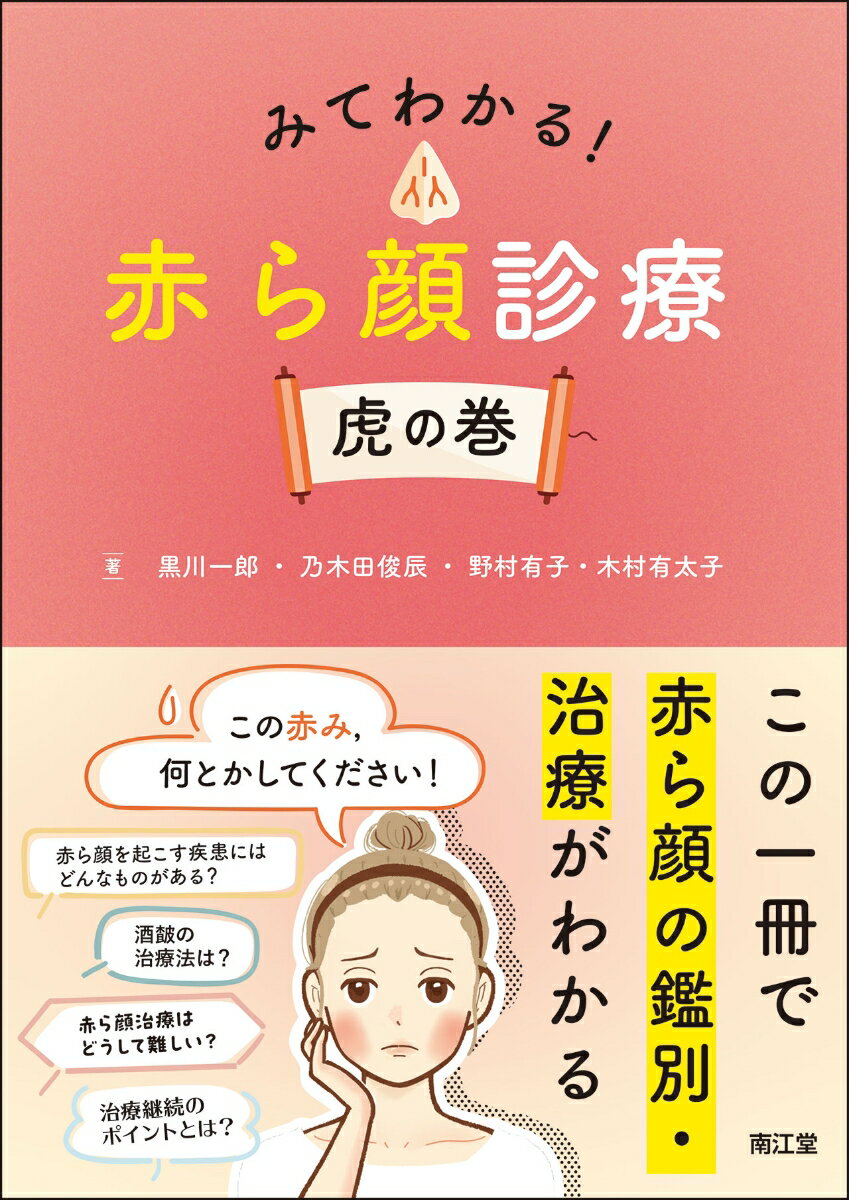 みてわかる！赤ら顔診療 虎の巻