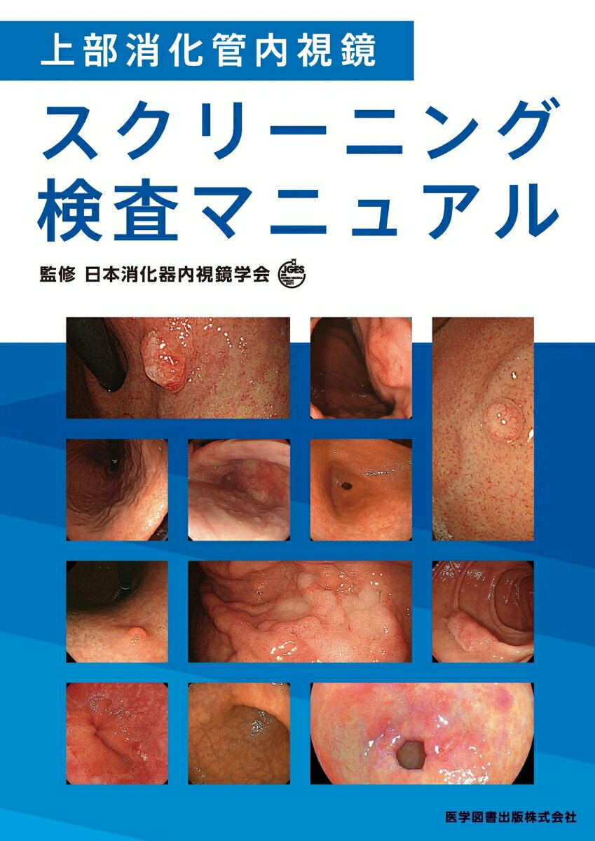 上部消化管内視鏡スクリーニング検査マニュアル