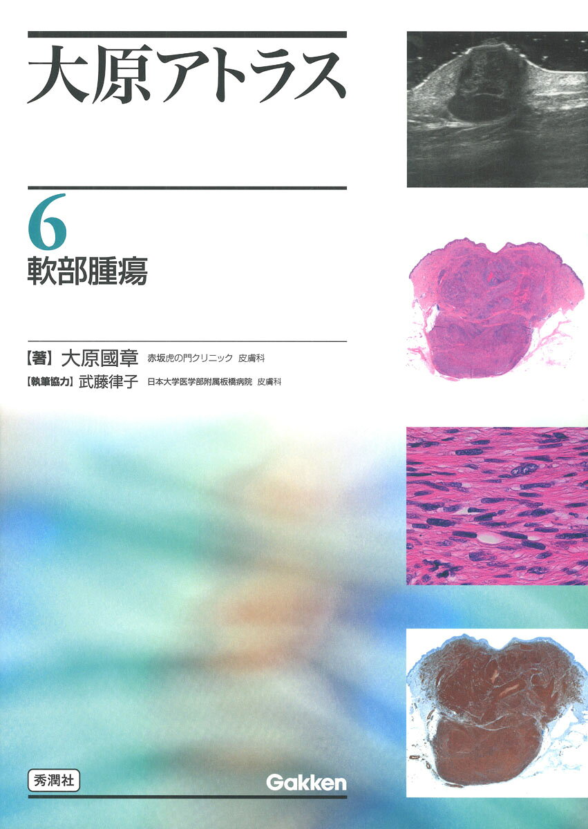 大原アトラス，最新作！今もグローバルに活躍する皮膚科の名医，大原國章先生の仕事の中の「軟部腫瘍」について，その臨床像・病理・画像を圧倒的な量の写真で示した．疾患別に系統立てて網羅的に解説．皮膚外科の神髄を余すことなく解説！
主な目次：
【主な目次】
1章　脂肪
2章　線維芽細胞，筋線維芽細胞，線維組織球性腫瘍，組織球性腫瘍
3章　脈管性腫瘍および腫瘍類似病変
4章　周皮細胞性および血管周皮性
5章　平滑筋
6章　神経
7章　骨軟部発生未分化小円形細胞肉腫
8章　骨・軟骨
9章　分類不能
10章　その他