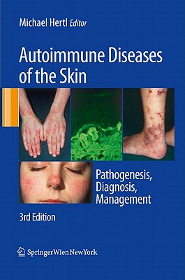 ŷ֥å㤨Autoimmune Diseases of the Skin: Pathogenesis, Diagnosis, Management AUTOIMMUNE DISEASES OF SKIN-3E [ Michael Hertl ]פβǤʤ46,376ߤˤʤޤ
