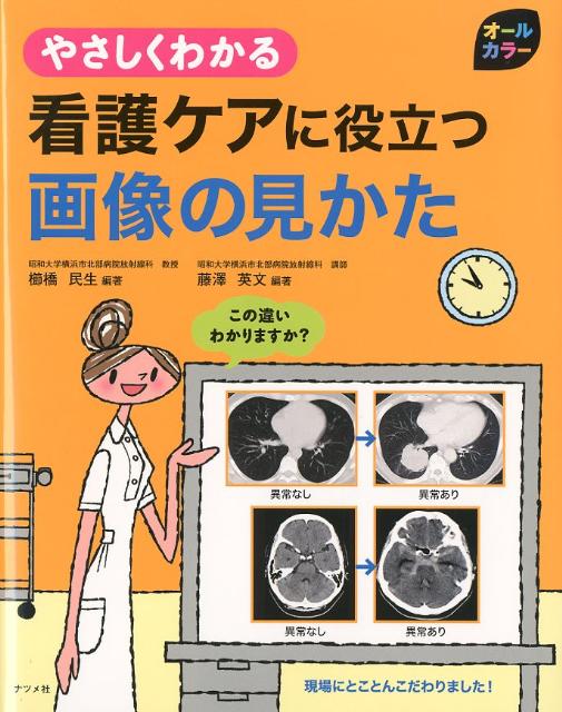 やさしくわかる看護ケアに役立つ画像の見かた
