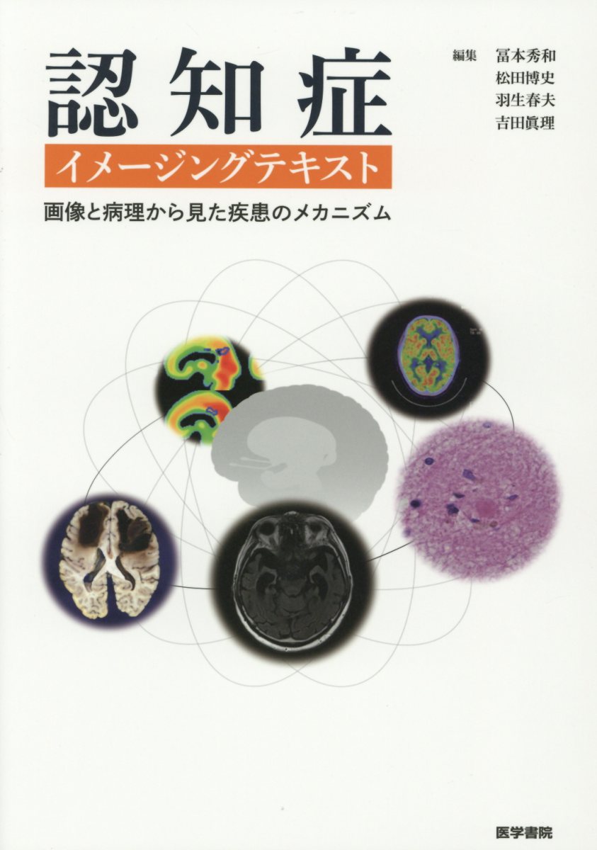 認知症イメージングテキスト 画像と病理から見た疾患のメカニズム [ 冨本 秀和 ]