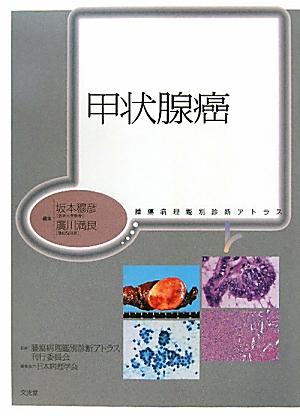 甲状腺癌