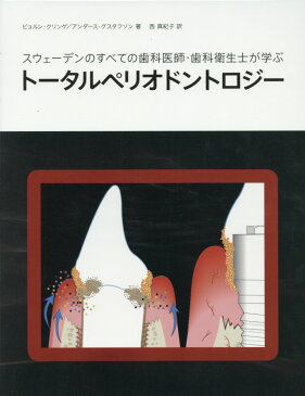 スウェーデンのすべての歯科医師・歯科衛生士が学ぶトータルペリオドントロジー [ ビョルン・クリンゲ ]