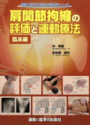 肩関節拘縮の評価と運動療法　臨床編