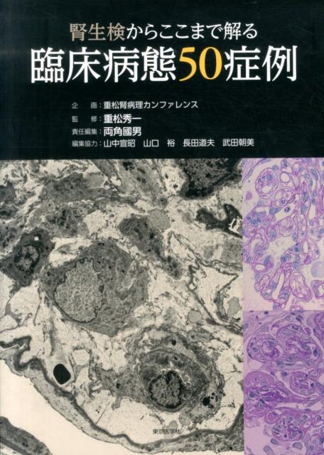 腎生検からここまで解る臨床病態50症例