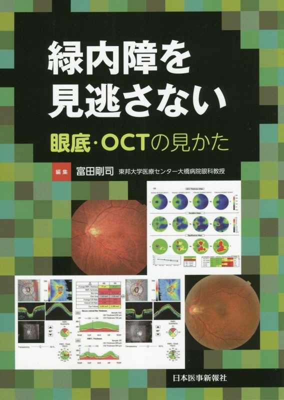 気質アップ 楽天市場】実戦緑内障 眼底所見で診る緑内障乳頭の通販 医学一般