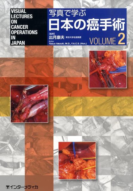 写真で学ぶ日本の癌手術（VOLUME2）