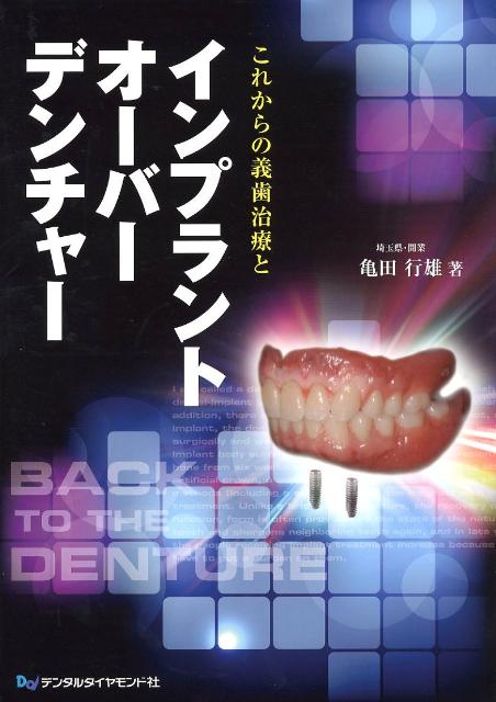 これからの義歯治療とインプラントオーバーデンチャー