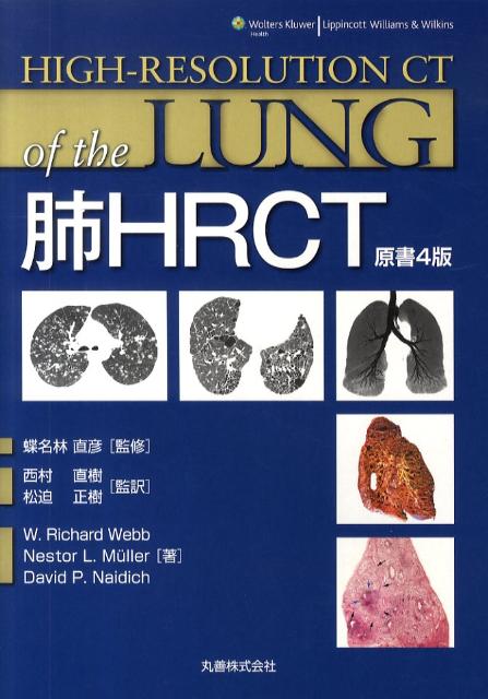 肺HRCT