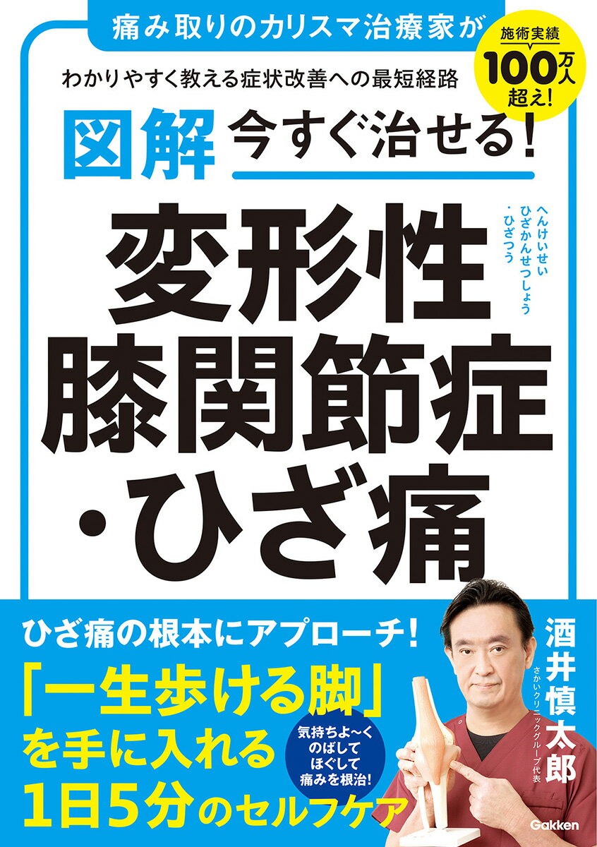 図解　今すぐ治せる！　変形性膝関節症・ひざ痛 [ 酒井 慎太郎 ]