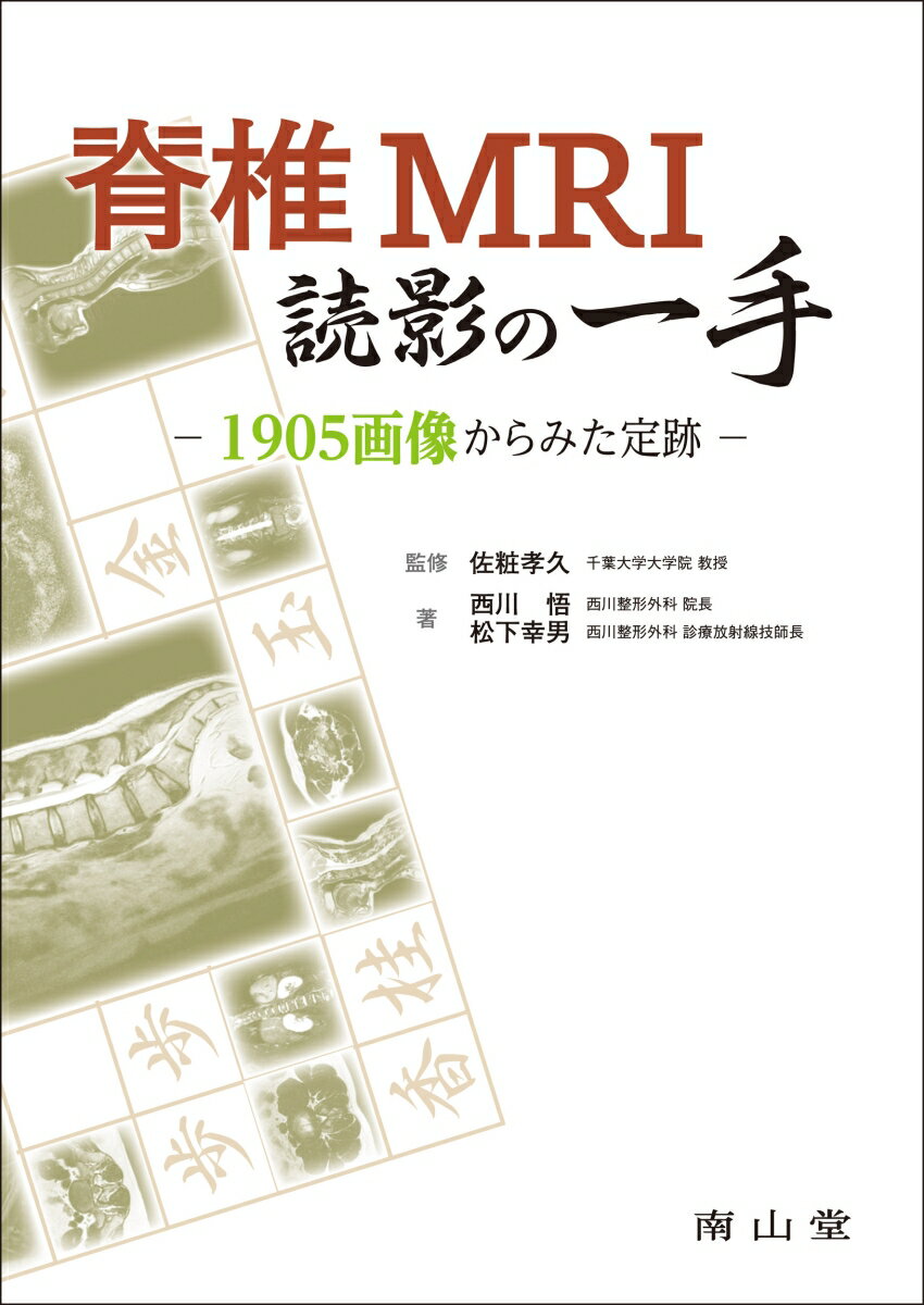 脊椎MRI読影の一手 1905画像からみた定跡 佐粧 孝久