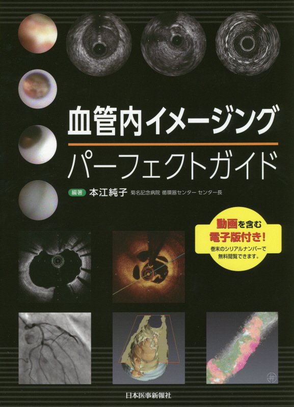 ＩＶＵＳ？ＯＣＴ／ＯＦＤＩ？血管内視鏡？それぞれの強みと弱点をふまえ、適切に使用するためのポイントやコツをエキスパートが徹底解説。「どの症例で何を使用するべきか」という悩みに答えます。