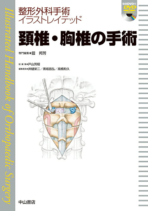 頚椎・胸椎の手術［DVD付］