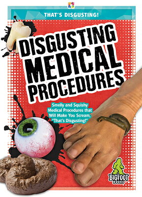 Disgusting Medical Procedures DISGUSTING MEDICAL PROCEDURES （That's Disgusting!） 