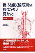 骨・関節X線写真の撮りかたと見かた第7版